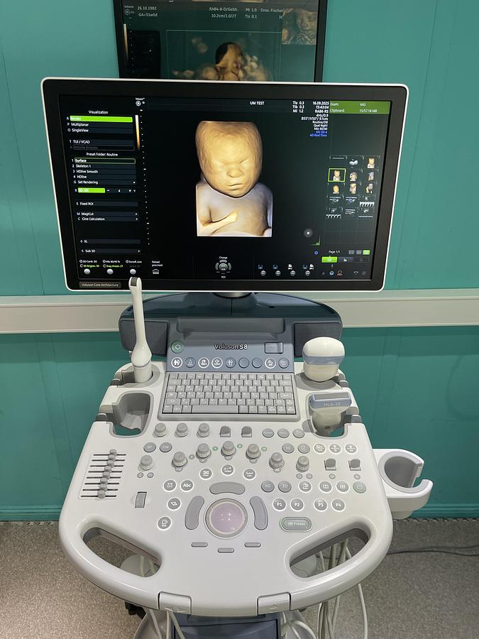 Gebraucht GE Voluson S8 Ultraschallgerät mit drei Sonden und Drucker