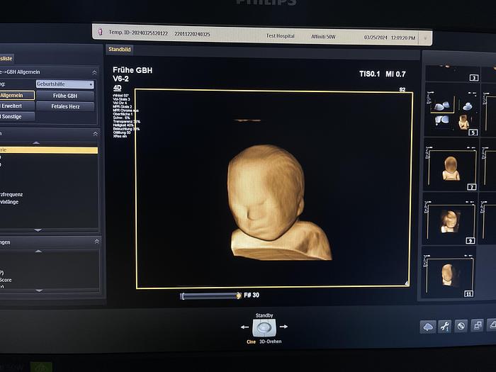 Gebraucht Philips V6-2 3D/4D Volumen Ultraschallsonde