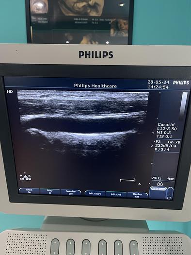 Gebraucht Philips L12-5 50 Linear Ultraschallsonde
