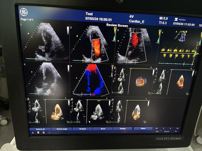 Gebraucht GE Vivid E9 XDClear Ultraschallgerät mit 2 Sonden