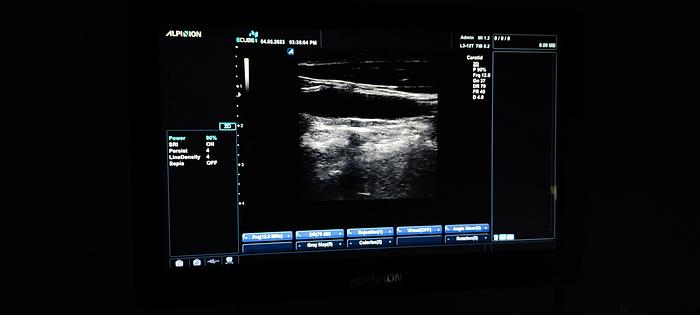 Gebraucht Alpinion ECUBE 5 Flachbildschirm-Ultraschallgerät inkl. 2 sonden Ultrasound