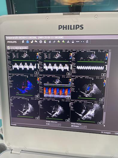 Gebraucht Philips CX50 Ultraschallgerät mit Sektor Sonde Model Version 5.0.2