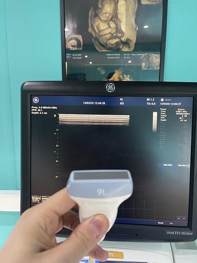 Gebraucht GE Vivid E9 XDclear Ultraschallgerät mit zwei Sonden #2015 