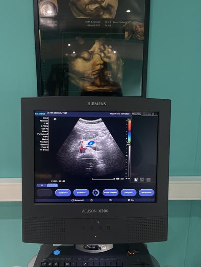 Used Siemens ACUSON X300 Ultraschallgerät mit drei Sonden 
