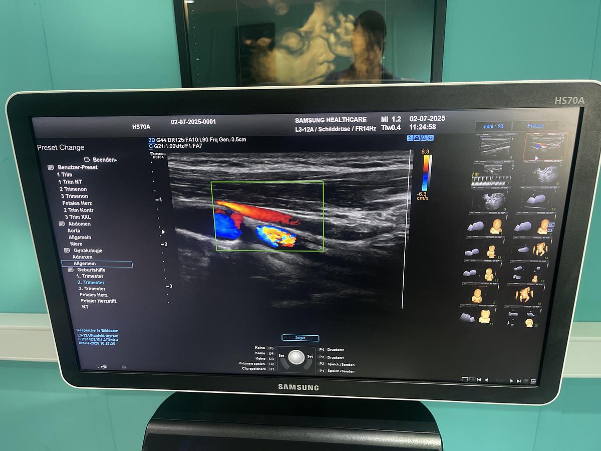 Gebraucht Samsung HS70A Ultraschallgerät mit drei Sonden