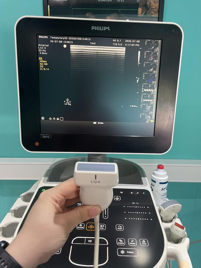 Gebraucht Philips Sparq Ultraschallgerät mit drei Sonden und Drucker