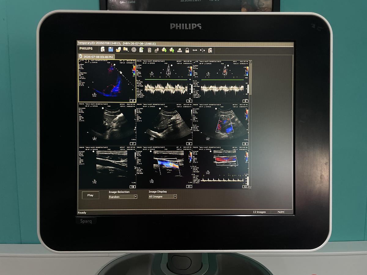 Gebraucht Philips Sparq Ultraschallgerät mit drei Sonden und Drucker