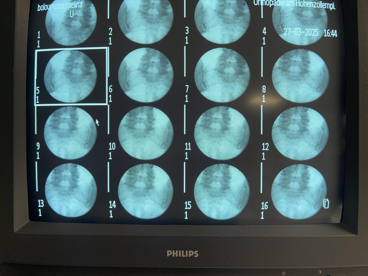 Used Philips BV Libra C-Bogen-System