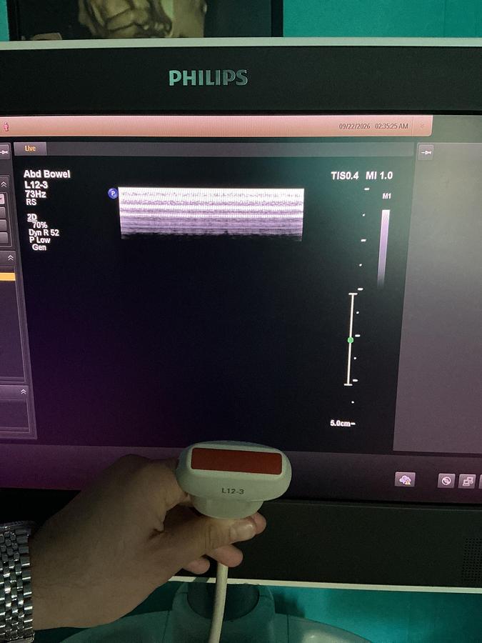 Gebraucht Philips L12-3 Linear Ultraschallsonde