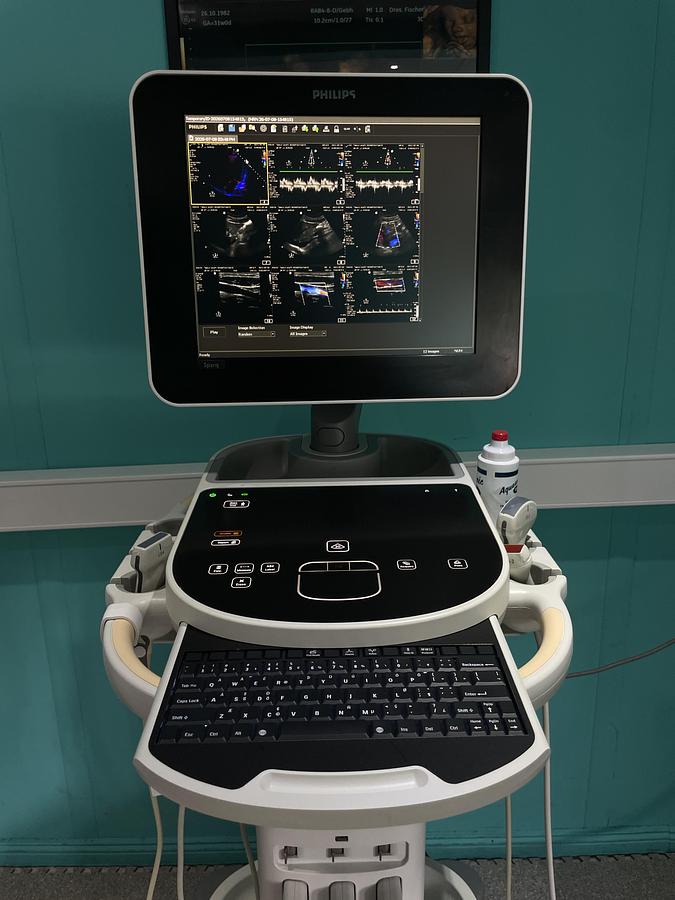 Gebraucht Philips Sparq Ultraschallgerät mit drei Sonden und Drucker