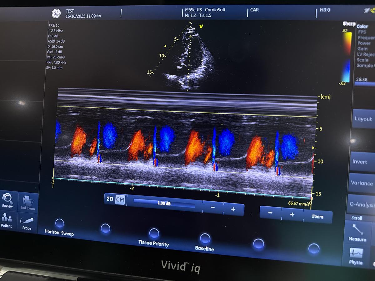 Gebraucht GE M5Sc-RS Kardio Ultraschallsonde