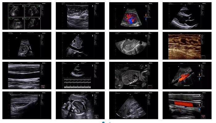 Philips InnoSight Kompaktes Ultraschallsystem