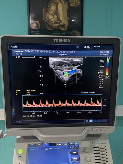 Used Toshiba Aplio 400 Ultraschallgerät mit 2 Sonden