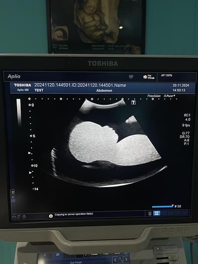 Used Toshiba Aplio 400 Ultraschallgerät mit 2 Sonden