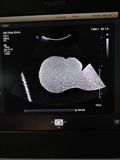 Gebraucht Philips C5-1 Konvex PureWave Ultraschallsonde