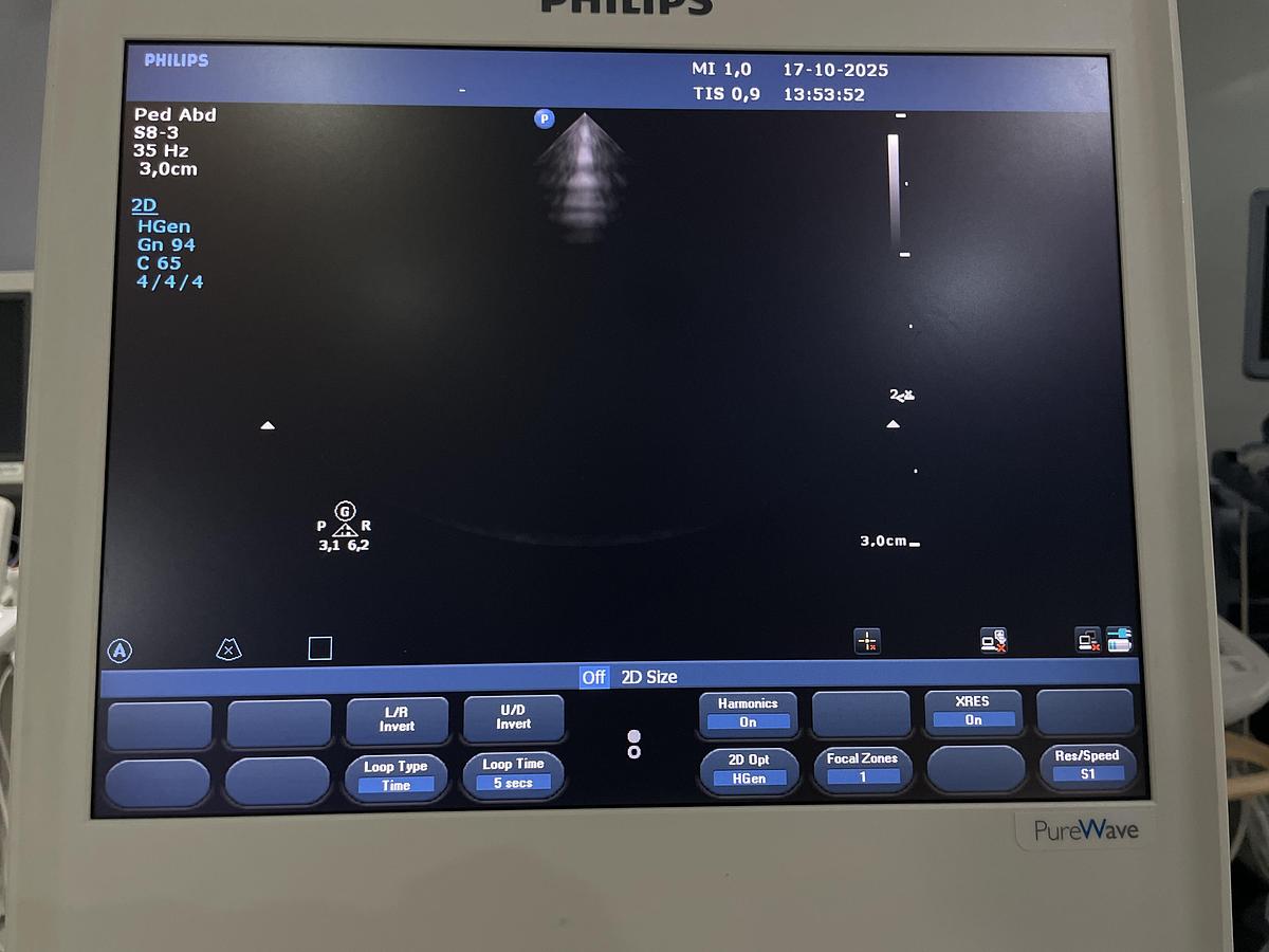 Gebraucht Philips S8-3 Kardio Ultraschallsonde