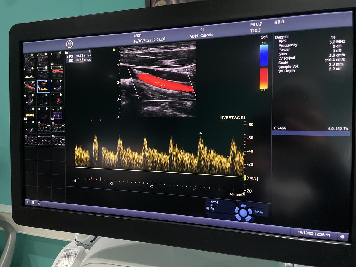 Gebraucht GE Vivid E95 v202 Ultraschallgerät mit zwei Sonden