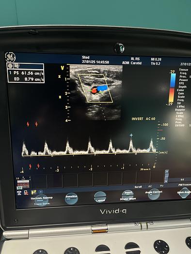 Used GE 8L-RS Linear Ultraschallsonde 