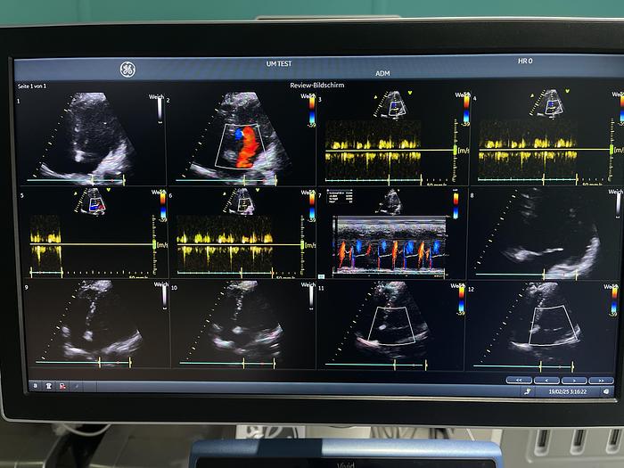 Gebraucht GE 3SC-RS Sektor Ultraschallsonde 