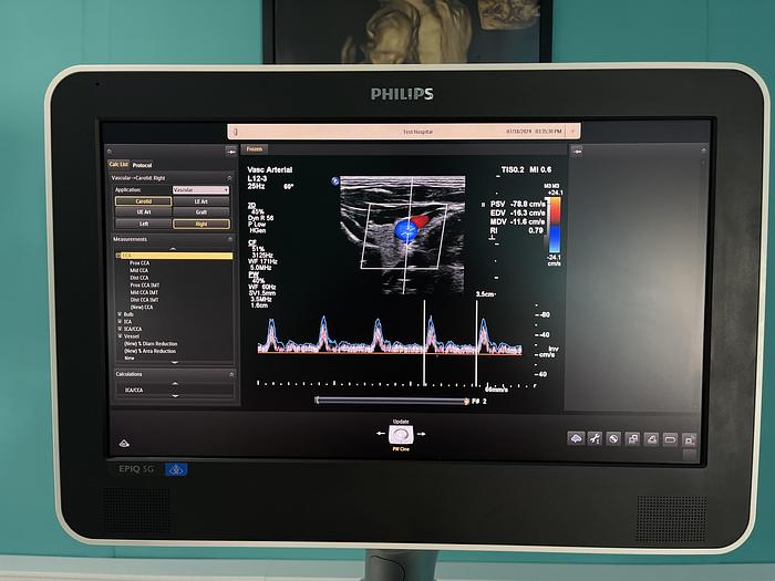 Used Philips EPIQ 5G Ultraschallgerät mit zwei Sonden