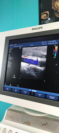 Gebraucht Philips L12-3 Linear Ultraschallsonde