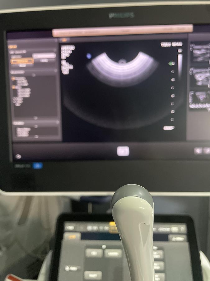 Gebraucht Philips C10-3V Endovaginal Ultraschallsonde 