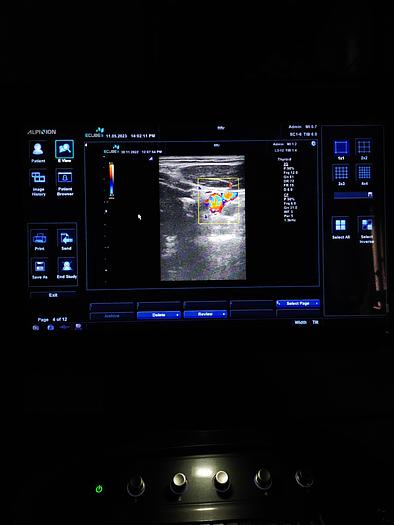 Gebraucht Alpinion E cube 9 Ultraschallgerät SW 2.6 mit 2 Sonde