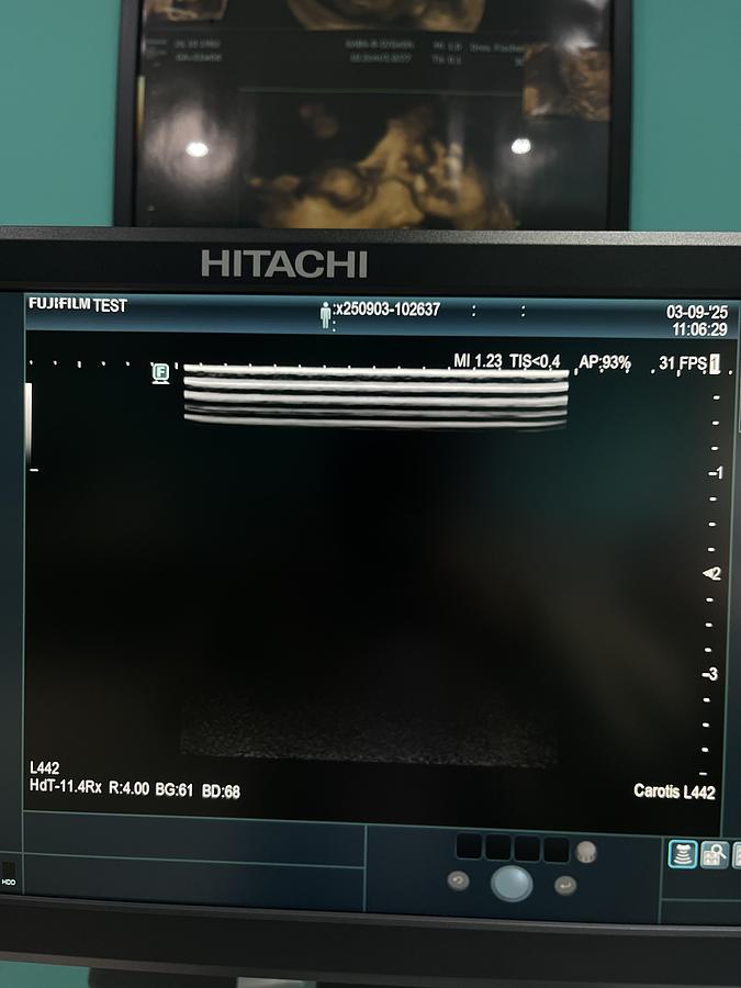 Gebraucht Hitachi ALOKA Arietta 65 Ultraschallgerät mit zwei Sonden