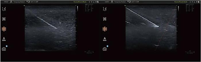 Vinno Q tragbares Ultraschallgerät