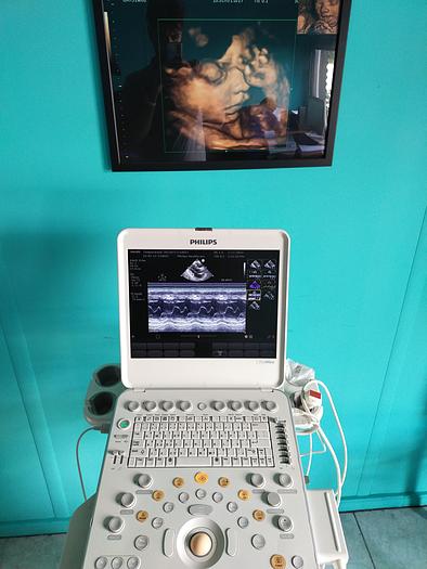Gebraucht Philips CX50 Ultrasound with S5-1 and Trolly