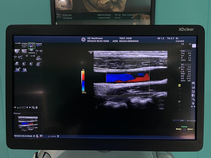 Gebraucht GE LOGIQ E9 XDClear 2.0 SW R6 Ultraschallgerät