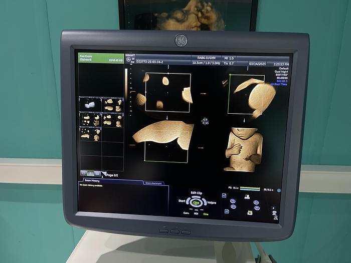 Gebraucht GE Voluson E8 BT13.5 Ultraschallgerät mit drei Sonden