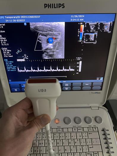 Used Philips L12-3 Linear Ultraschallsonde