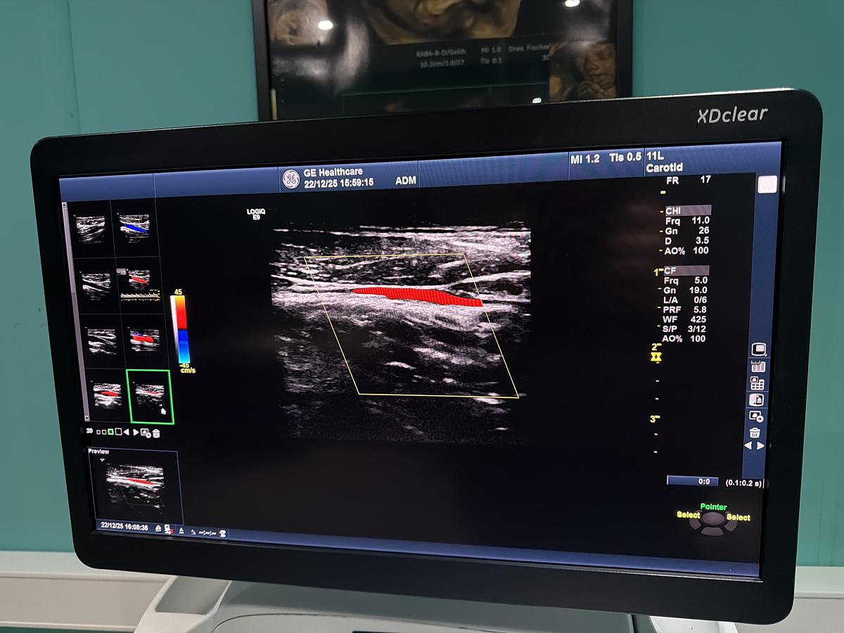Gebraucht GE LOGIQ E9 XDClear Elastography Ultraschallgerät mit zwei Sonden  