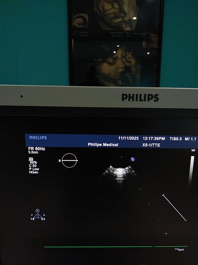 Gebraucht Philips iE33 Ultraschallgerät mit eine X5-1 Sonde