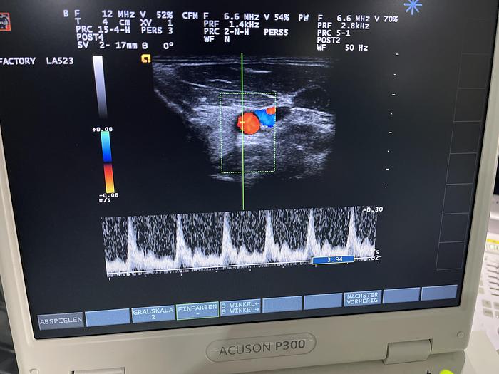 Used Esaote LA523 Linear Ultraschallsonde 