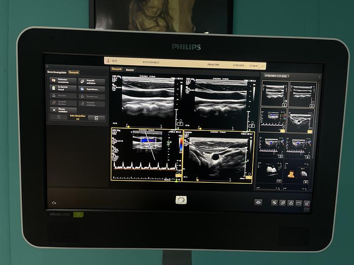 Gebraucht Philips Affiniti 50W Ultraschallgerät mit 3 Sonden und Drucker SV 9.0.5