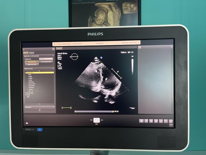 Used Philips EPIQ 5G Ultraschallgerät mit zwei Sonden