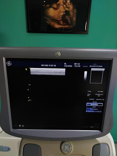 Gebraucht GE Vivid 7 Ultraschallgerät