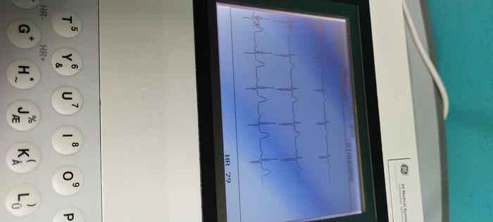 Gebraucht GE MAC 1200 ST EKG-Gerät