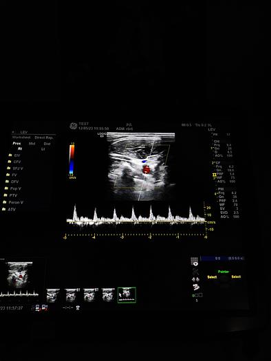 Gebraucht GE LOGIQ E9 Flachbildschirm-Ultraschallgerät inkl. 1 Sonde, Drucker und DVD-Brenner