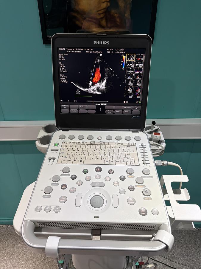 Gebraucht Philips CX50 XMATRIX HW E.0 SW 5.5.3 Ultraschallgerät mit zwei Sonden