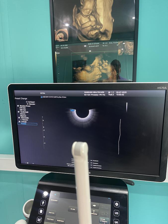 Gebraucht Samsung HS70A Ultraschallgerät mit drei Sonden