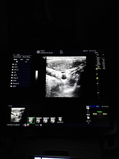 Gebraucht GE LOGIQ E9 Flachbildschirm-Ultraschallgerät inkl. 1 Sonde, Drucker und DVD-Brenner