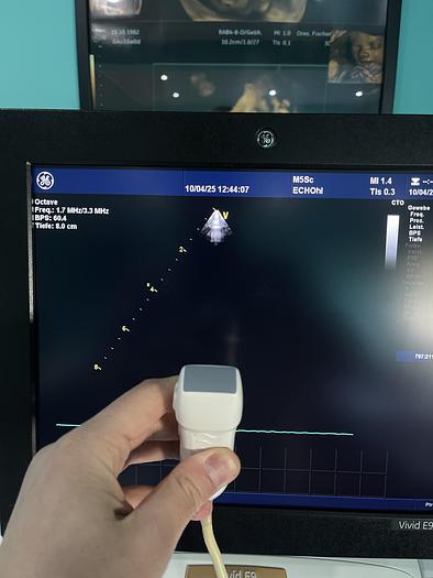 Gebraucht GE Vivid E9 XDclear Ultraschallgerät mit zwei Sonden und Drucker