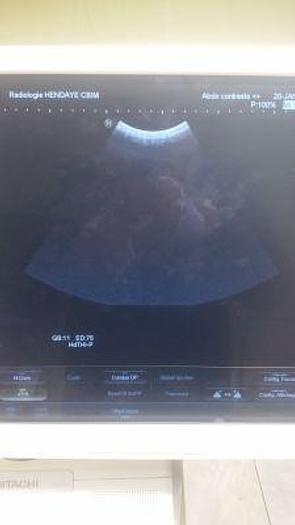 Used HITACHI HI VISION Preirus OB / GYN - Vascular Ultrasound