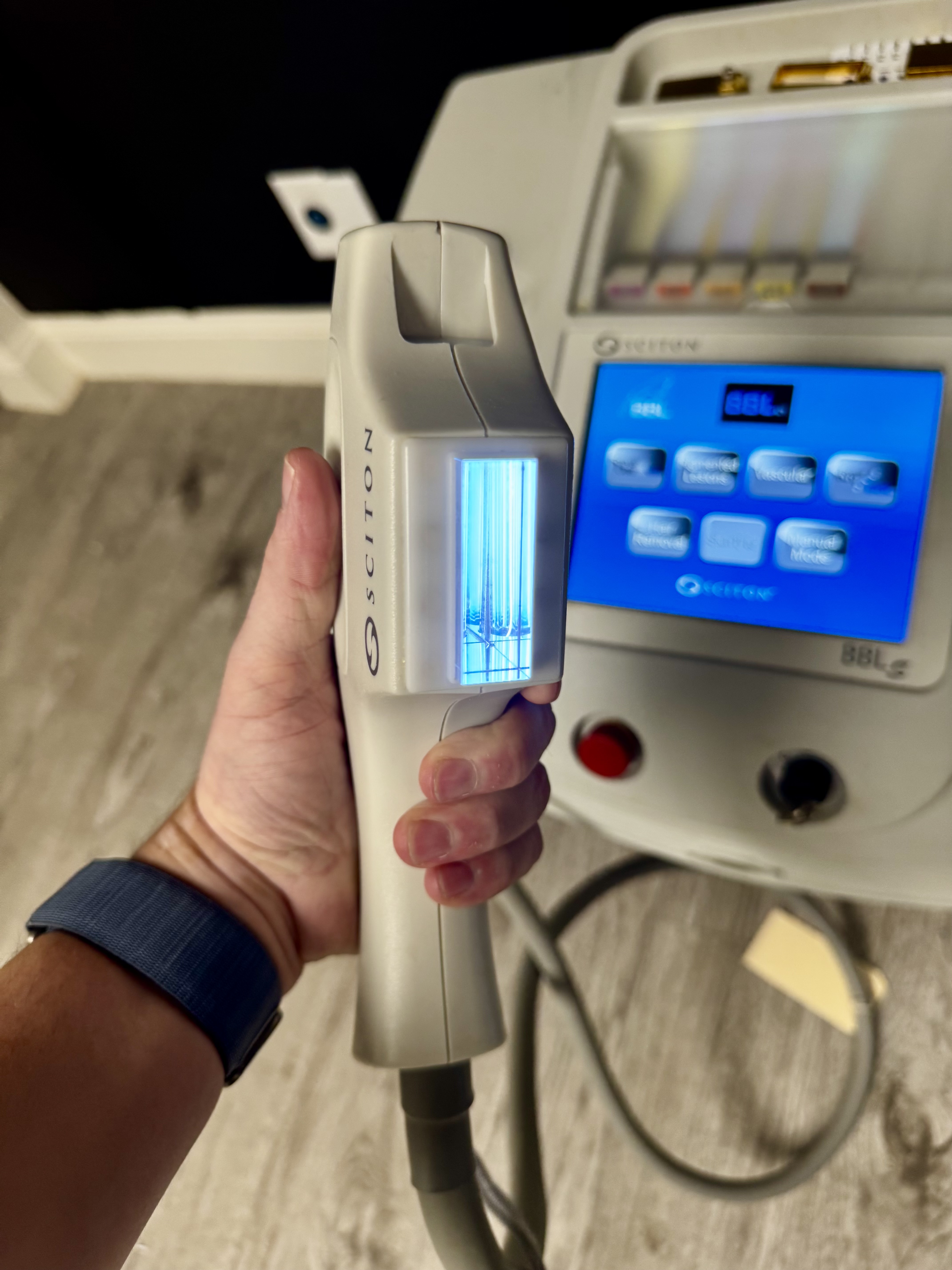 Refurbished Sciton BBL Handpiece- Sciton Refurbished - 0 Pulses!