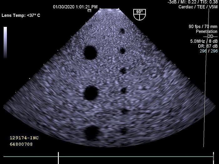 Used For Sale SIEMENS V5M Cardiac Ultrasound