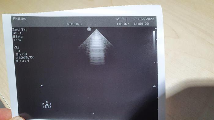 Gebraucht Philips S3-1 Sektor Ultraschallsonde