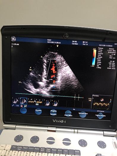 Used GE Vivid i Ultraschallgerät mit Kardio-Sonde Software Version 2.1.16 auf GE Vivid i Trolley